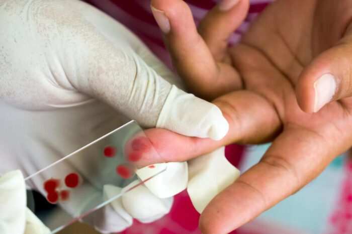 malaria testing